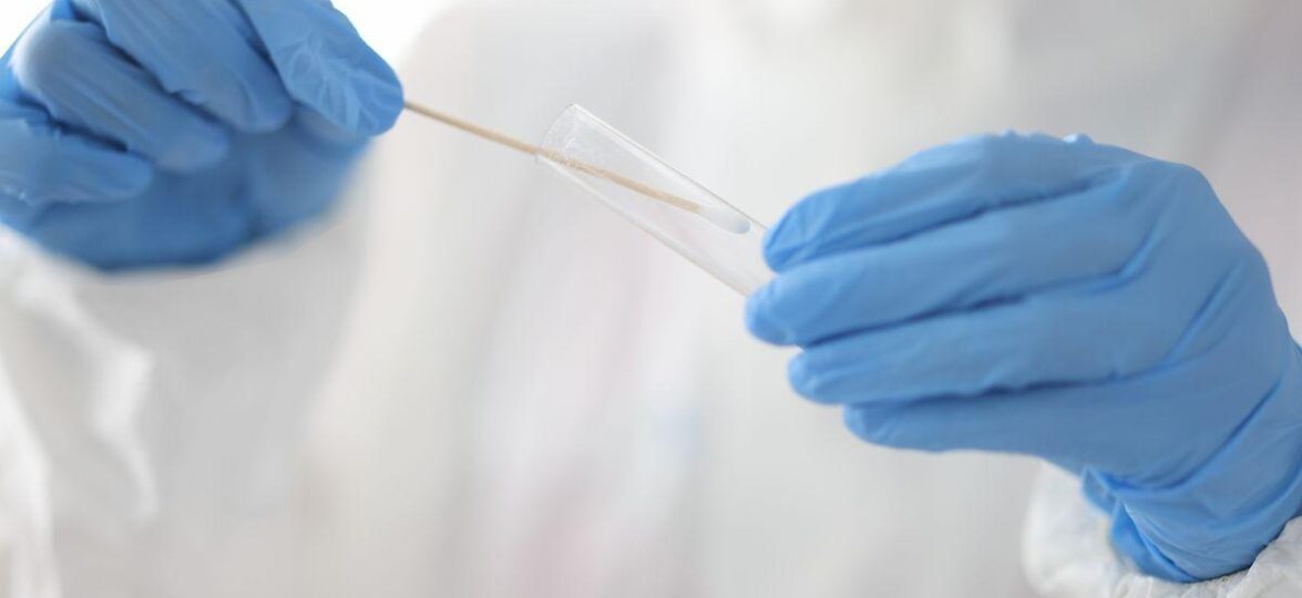 тест после Абхазии _medical-gloves-laboratory